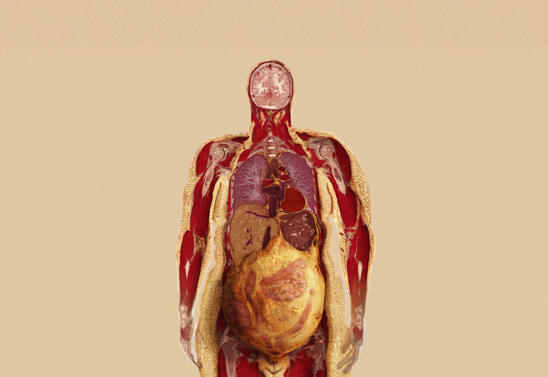 Important to Know and Reduce Visceral Fat